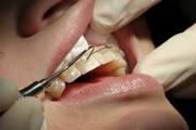 Reliable Dental Care for ethical Look