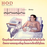 CT angiography cost in Delhi