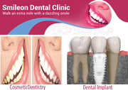 Best root canal treatment| Dental Implants in India