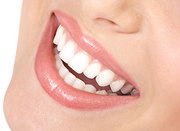 Get the Quality Porcelain Veneers in Delhi - Smileoracles