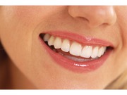 Best and Affordable Teeth Whitening in Delhi