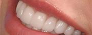 Best Cosmetic Dentistry in Delhi 