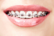 Get The The Best Orthodontic Treatment In Delhi