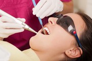 Get The World Class Laser Treatment For Teeth