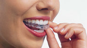 Orthodontic Treatment in Delhi