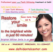 Laser whitening Dentist in East Delhi