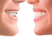 Worldclass Orthodontic Treatment in Delhi