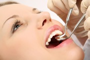 Teeth Implant in Delhi