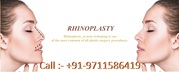 Rhinoplasty