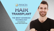 Hair Transplant in Delhi,  Hair Transplant Clinic in Delhi