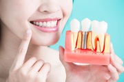 Benefits of Going for Adult Orthodontic Treatment