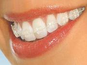 Best Orthodontist in Delhi | Dr. Gargi Kandhari