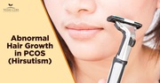 Hirsutism in PCOS