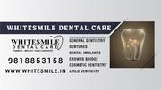 Dental Surgeon in Delhi | White Smile