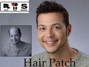 Rizy Hair Solution | Hair Patches | Hair Wigs | Hair Transplant		