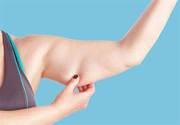 Arm Lift Surgery in India at Affordable Cost South West Delhi