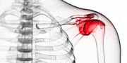 Choose the Best Shoulder Surgeon in Delhi - AOSM