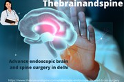 Advance endoscopic brain and spine surgery in delhi