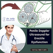 Penile Doppler Ultrasound for Erectile Dysfunction Gk in Delhi
