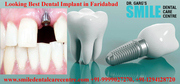 Looking Best Dental Implant in Faridabad or Delhi NCR