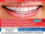 Get Best Invisible Aligner Treatment in Faridabad India 