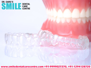 Best Invisible Aligner Treatment Get at Our Dental Clinic
