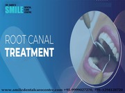 Painless Root Canal Treatment by Professional Endodontist