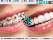 Best Orthodontist in Faridabad To Get Orthodontic Treatments