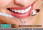 Best Orthodontist in Faridabad- Braces Treatment