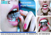 Best Invisible Aligner Treatment By Certified Orthodontist