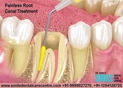 Best Dental Clinic For Painless Root Canal Treatment in Faridabad Indi