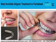 Best Invisible Aligner Treatment in Faridabad Experienced Orthodontist