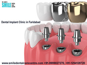 Best Dental Implant in Faridabad- Clinics