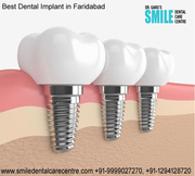 Dental Implant Clinic in Faridabad – Treatment At Affordable Cost