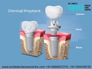 Advanced Dental Implants Treatment in Faridabad