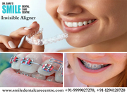 How Best Invisible Aligner Treatment Impacts Life?