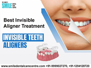 How To Get Best Invisible Aligner Treatment in Faridabad