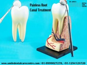 Best Dental Clinic For Painless Root Canal Treatment in Faridabad