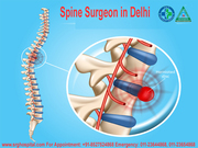 Consult Best Spine Specialist In New Delhi -Avoid Spine Surgery