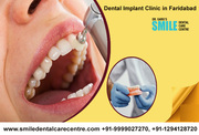 Best Dental Implants Treatment in Faridabad