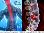 Thinking How To get Best Spine Surgeon or Spine Specialist In New Delh