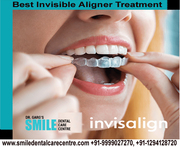 Clear Solution To Straightening Teeth Known As Best Invisible Aligner 