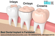 Dental Implants Treatment - Dental Implant Clinic in Faridabad