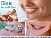 Straighten Your Teeth For A Better Smile Known Best Invisible Aligner 