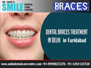 Dental Braces Treatment in Faridabad At Smile Dental Care Centre
