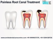 Painless Root Canal Treatment Who Required