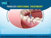 Painless Root Canal Treatment in Faridabad