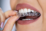 Orthodontic Without Braces Treatment in Gurgaon - Stoma Dentals