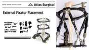 Orthopaedic External Fixator Placement - Surgical Implants & Instrumen