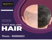 Best Hair Transplant Surgeon in Delhi and Gurgaon At Oneaesthetics 